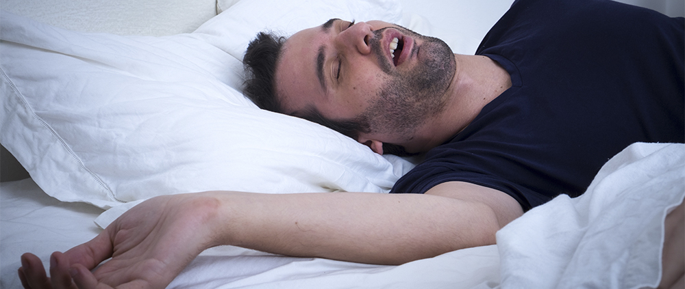 Apnea notturna alternativa alla CPAP